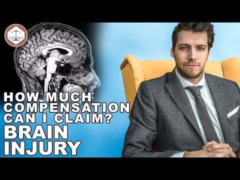 Navigating Legal Claims for Brain Damage Compensation in the UK